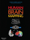 Human Brain Mapping封面